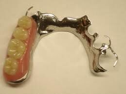 cast-partial-denture-9209046